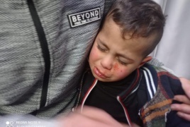 مستوطنون يصيبون طفلا (3 سنوات) بجروح على مدخل برقة شمال شرق رام الله