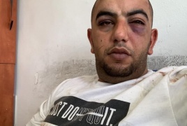الإفراج عن المقدسي أحمد فراح بكفالة مالية وإبعاده 15 يوماً عن حي الشيخ جراح