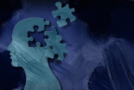 أمريكا تثير الجدل بعقار جديد لعلاج ألزهايمر