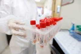 لا وفيات و173 إصابة جديدة بفيروس كورونا و179 حالة تعاف خلال الأربع والعشرين ساعة الأخيرة