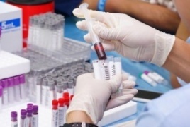 الصحة العالمية تحذر من متحور "لامبدا"... وعدد المتحورات بلغ 11 طفرة حتى الان
