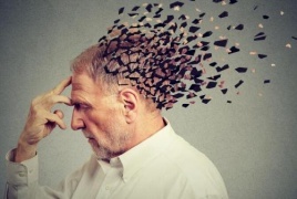 طريقة علاج جديدة لمرض الزهايمر