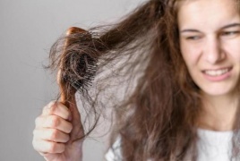 أسباب تساقط الشعر متعددة
