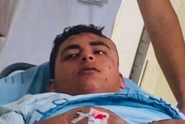 مستوطنون يعتدون على شاب من جبل المكبر في القدس