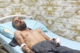 الديك : وزيرة الصحة تصدر تعليماتها لعلاج الجريح أسامه الشحاتيت فورا