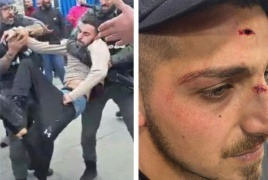 الاحتلال يعتدي بشكل وحشي على مقدسيين