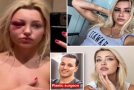 حول جراح تجميل عارضة أزياء أجنبية من أصول شرقية  إلى عبدة جنسية في الولايات المتحدة 