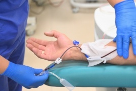 سجلت أمريكية تعيش بكلية خنزير  رقما قياسيا جديدا