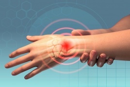 أطعمة تقلل من تطور التهابات المفاصل