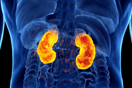 عادات شائعة تتلف الكلى بصمت