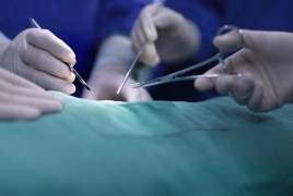 مريضة تحقق رقما قياسيا بالعيش 130 يوما بكلية خنزير قبل أن يرفضها جسمها