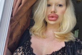 رسالة من صاحبة "أكبر شفاه في العالم"