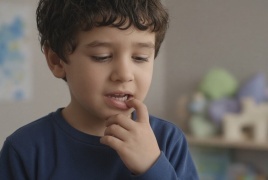 مواد كيميائية في الأسنان اللبنية تثير تساؤلات حول علاقتها بالتوحد