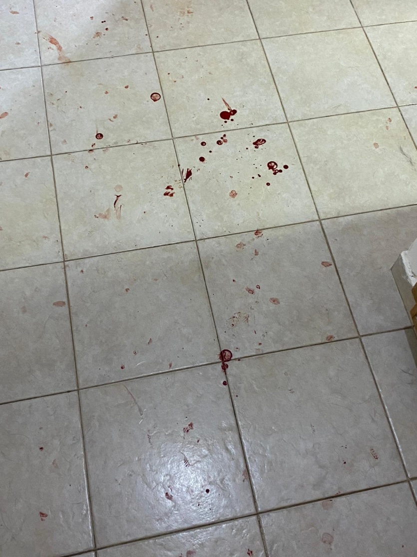 قوات الاحتلال تعتدي بالضرب المبرح على الطفل شادي خوري