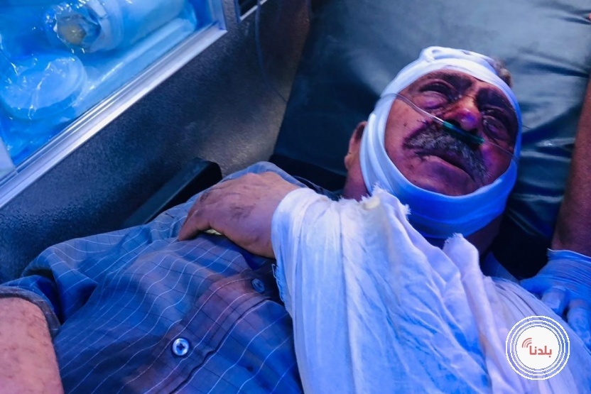 إصابة 6 مواطنين أحدهم بالرصاص الحي باعتداء للمستوطنين شمال رام الله