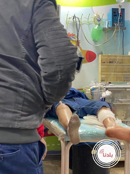 إصابة فتى بالرصاص الحي بمخيم العروب