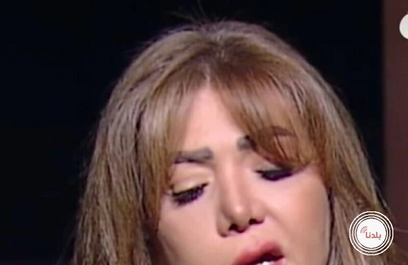 فنانة مصرية شهيرة تروي مأساة إصابتها بـ"شلل الوجه"