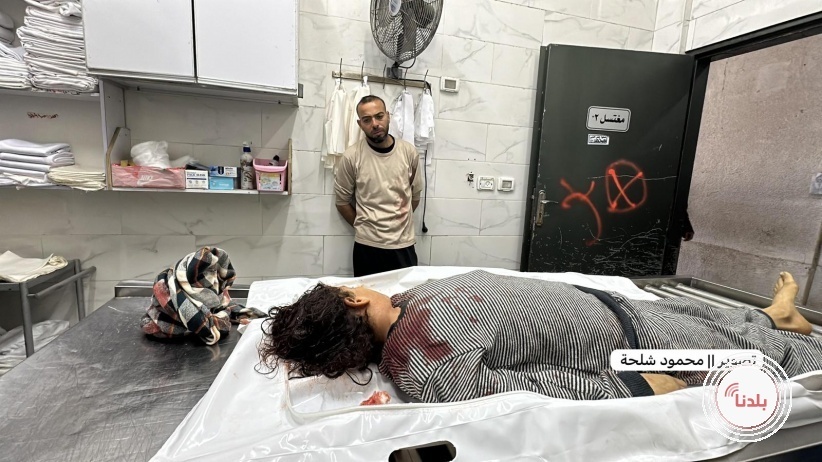 شهداء واصابات بغزة وجباليا والاحتلال يطلق الرصاص على طول الخط الأصفر