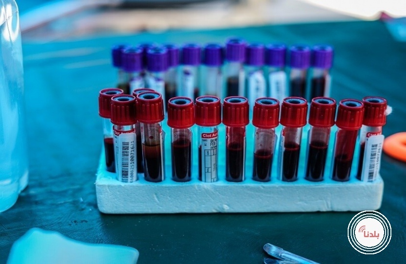 خمسة مؤشرات في الدم تكشف مشكلات صحية خطيرة