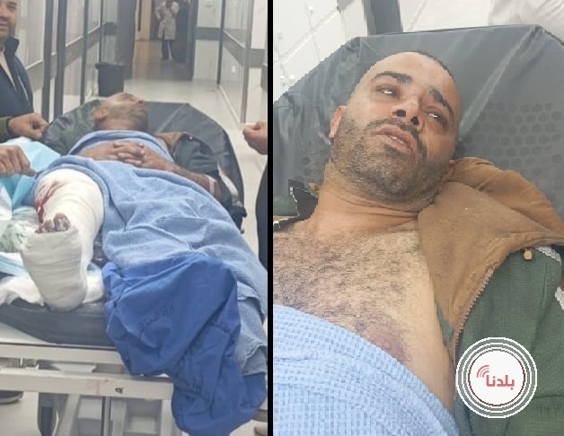 إصابة شاب برصاص الاحتلال غرب الخليل