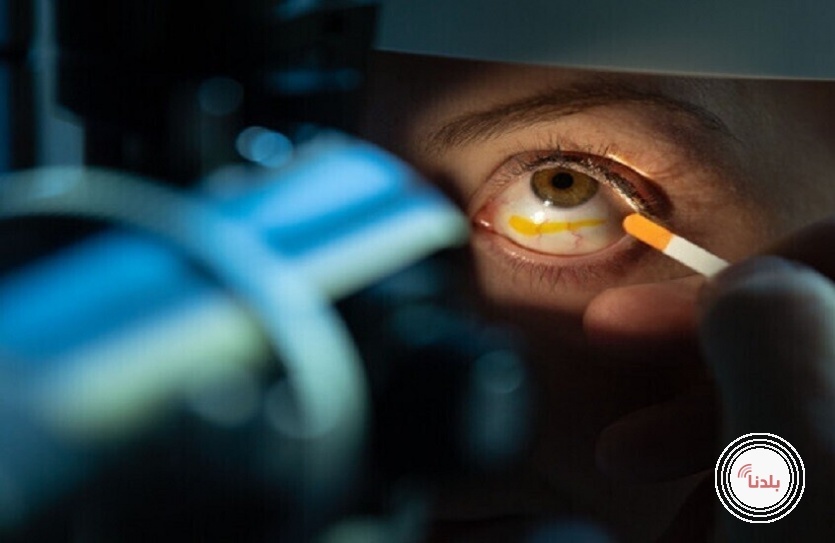 فيروس يصيب الحيوانات المائية ينتقل لعين الإنسان!