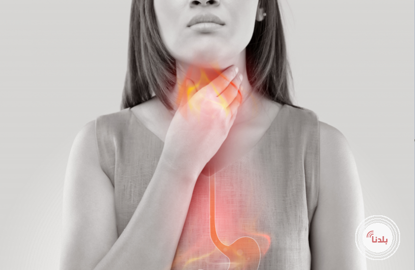 نصائح عملية بسيطة للتخفيف من حرقة المعدة